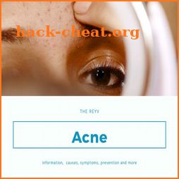 Acne: Causes, Treatment, And Tips icon