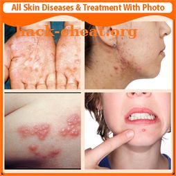 All Skin Diseases and Treatment icon