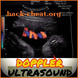Basic Principles of Doppler Ultrasound icon