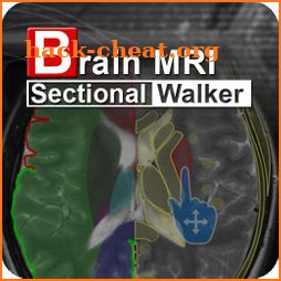 Brain MRI Sectional Wlker icon