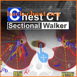 Chest CT Sectional Walker icon