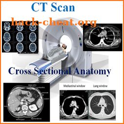 CT Scan Cross Sectional Anatomy icon