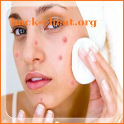 Get Rid of Acne (Guide) icon