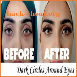 Get Rid Of Dark Circles Under Eyes icon