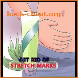 Get Rid Of Stretch Marks Naturally icon