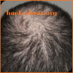 Hair Fall Home Remedies icon