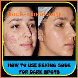 How to use Baking Soda for Dark Spots icon
