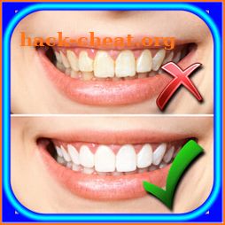 How to Whiten Teeth at home icon