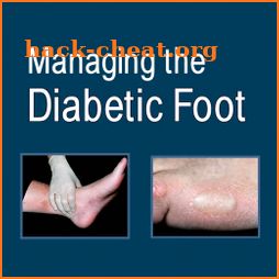 Managing the Diabetic Foot, 3e icon