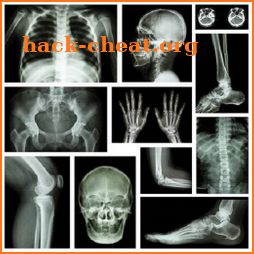 musculoskeletal x-ray interpretation icon
