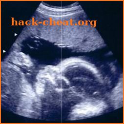 Pregnancy Baby & Baby Kick icon