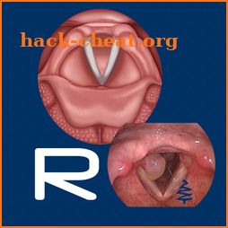 Reflux icon