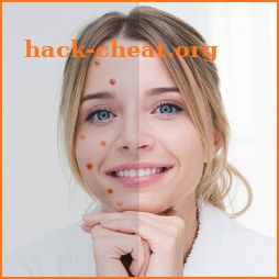 Remove Acne from Face icon