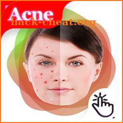 Remove pimples from photo -Acne And Pimple Remover icon