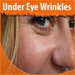 Under Eye Wrinkles Home Remedies icon