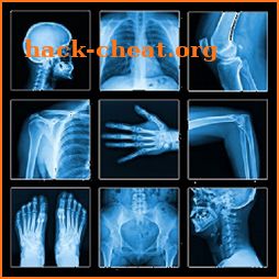 X-Ray -Medical XRay Interpretation with 100+ Cases icon