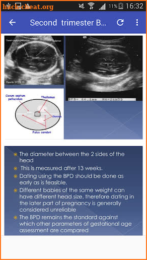2nd & 3rd trimester OB/GY Ultrasound screenshot