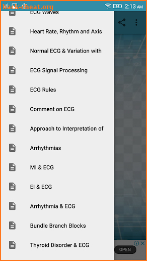 A to Z ECG Interpretation screenshot