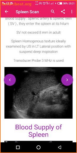 A-Z Abdominal Ultrasound screenshot