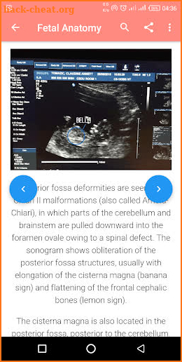 A-Z Obstetrics Ultrasound screenshot