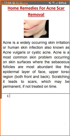 Acne Scar Removal screenshot