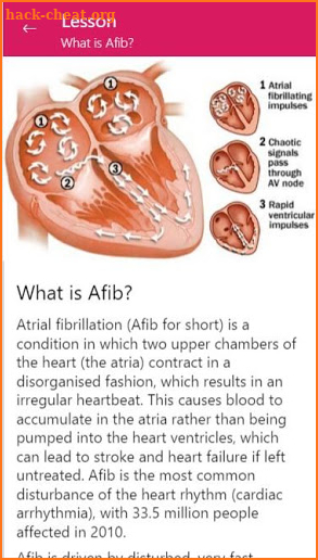 Afib Companion screenshot
