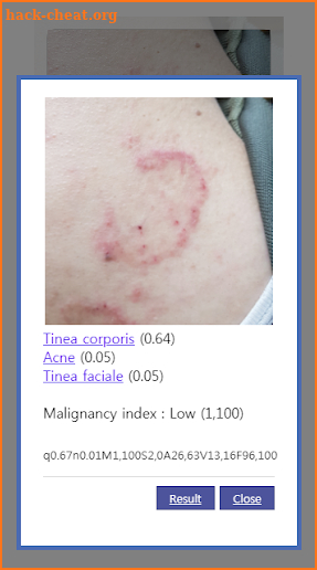 AI Dermatology - Skin Disease Diagnosis screenshot