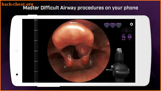 Airway Ex - Intubate. Anesthetize. Train. screenshot