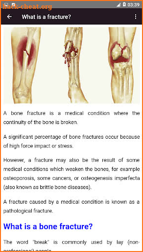 All bones diseases and treatments screenshot