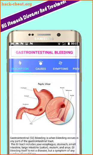 All stomach diseases and treatment screenshot