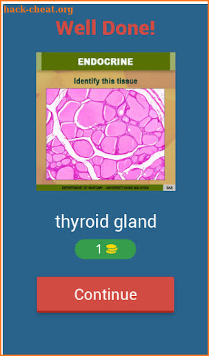 Anatomy Online Quiz: Endocrine System screenshot