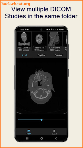 Anatomy Viewer: CT/MRI Images screenshot