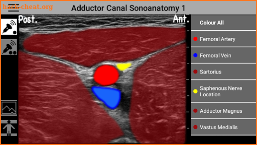 AnSo Anaesthesia Sonoanatomy screenshot