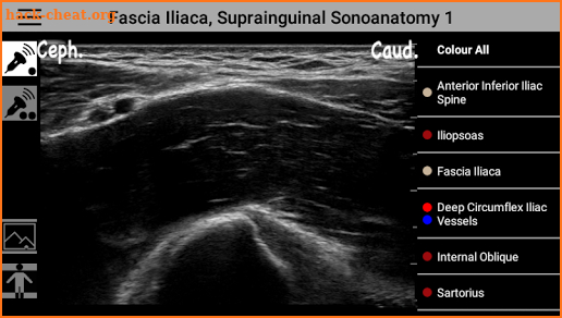 AnSo Anaesthesia Sonoanatomy screenshot
