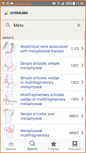 AO/OTA Fracture Classification screenshot