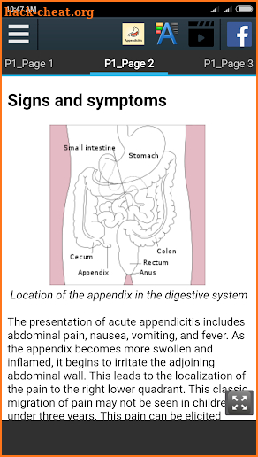 Appendicitis Info screenshot