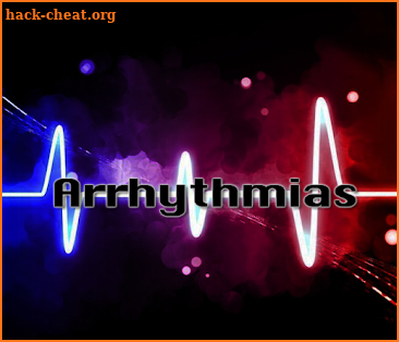 Arrhythmias and Dysrhythmias screenshot