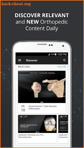 Arthrex Surgeon App screenshot