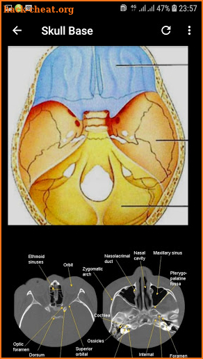 Atlas of CT Anatomy screenshot