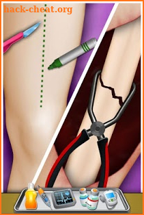Baby Surgery Emergency Operation Thigh Specialist screenshot