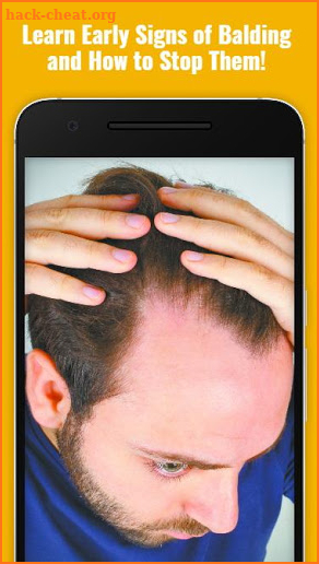 Baldness Thinning Hair screenshot