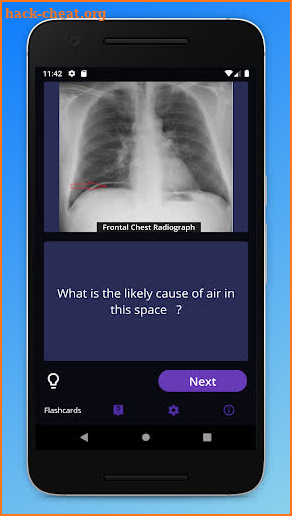Basic Radiology for medical students screenshot