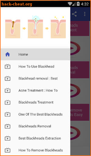 Blackheads Removal Videos screenshot
