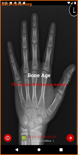 Bone Age screenshot
