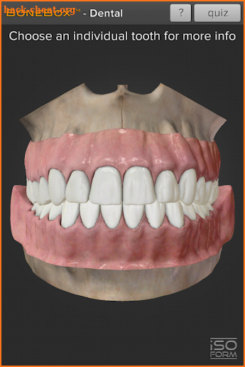 BoneBox™ - Dental Lite screenshot