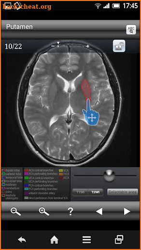 Brain MRI Sectional Wlker screenshot