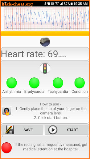 Cardiac diagnosis (heart rate, arrhythmia) screenshot