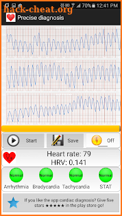 Cardiac diagnosis (heart rate, arrhythmia) screenshot