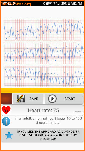 Cardiac diagnosis(formerly) Heart Rate Monitor screenshot