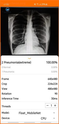 Chest X-Ray Classifier screenshot